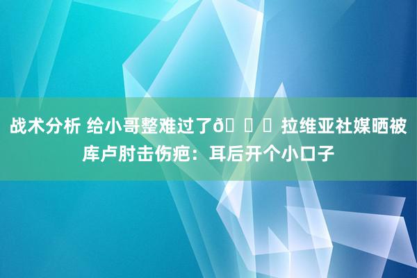 战术分析 给小哥整难过了😅拉维亚社媒晒被库卢肘击伤疤：耳后开个小口子